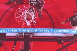 问啥詹姆斯！NBA篮板上沿有土耳其植发公司广告 手动@杰伦-布朗